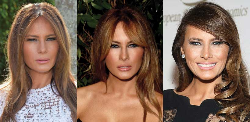 Melania Trump Plastic Surgery: A First Botox Lady?