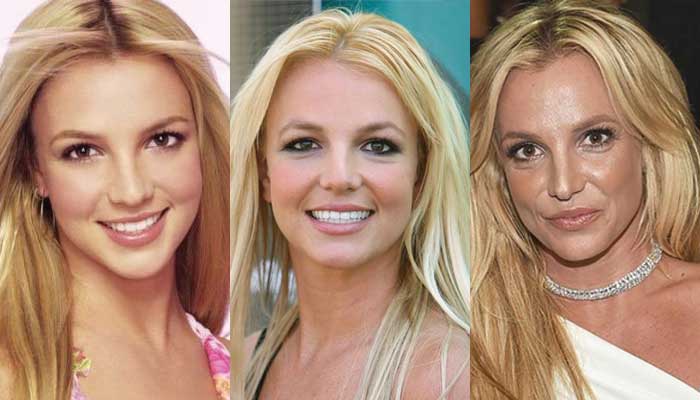 Britney Spears Plastic Surgery Before And After Pictures 2021