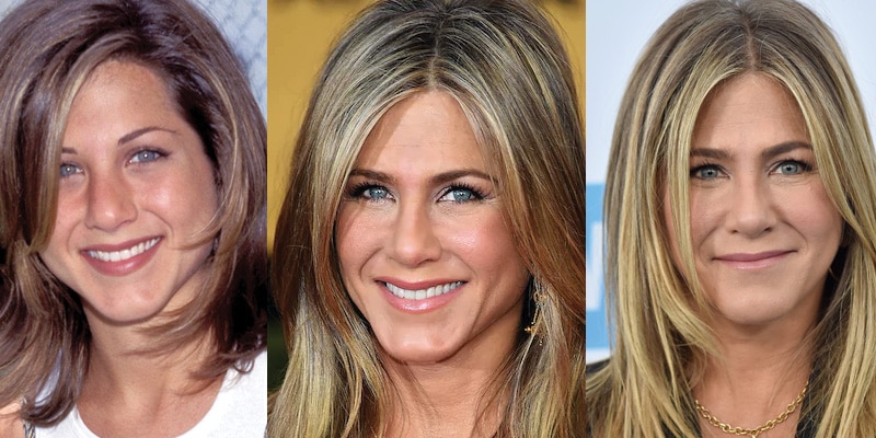 Celebrity Plastic Surgery Before and After 2019