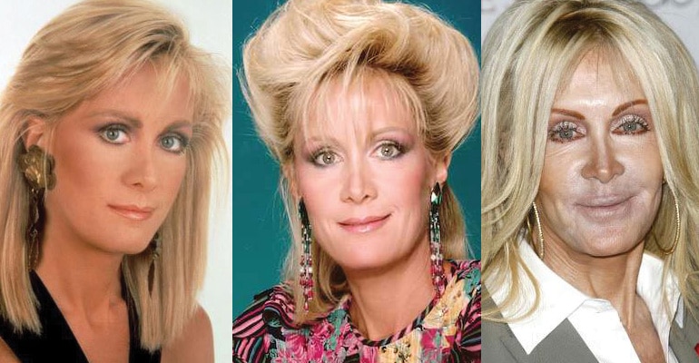 Joan Van Ark Plastic Surgery Before And After Pictures