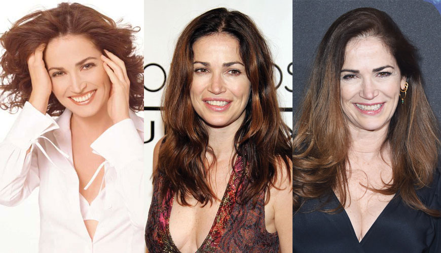 Kim Delaney Plastic Surgery Before and After Pictures 2020