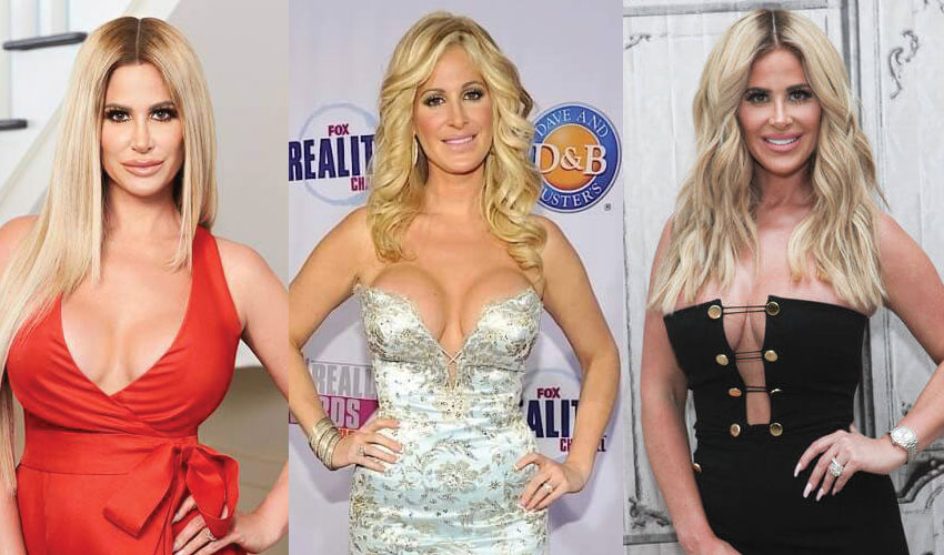 Kim Zolciak Plastic Surgery Before and After Pictures 2020