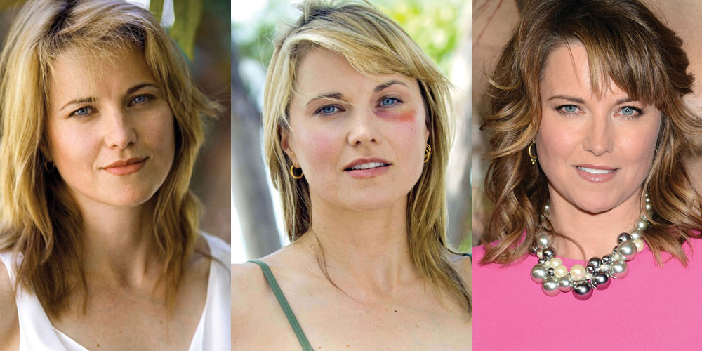 Lucy Lawless Plastic Surgery Before and After Pictures 2020